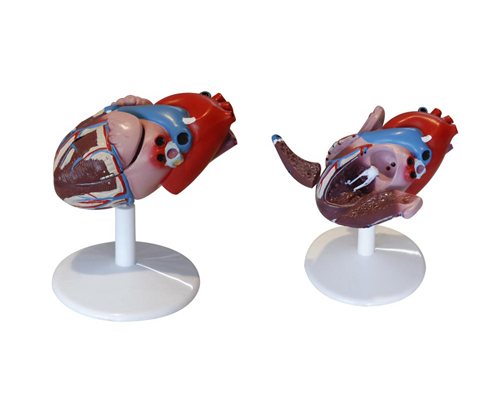 心臟解剖(自然大)(附病態(tài)動脈血管)